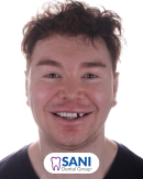 Before & After from Georgy Tupchiev