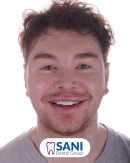 Before & After from Georgy Tupchiev