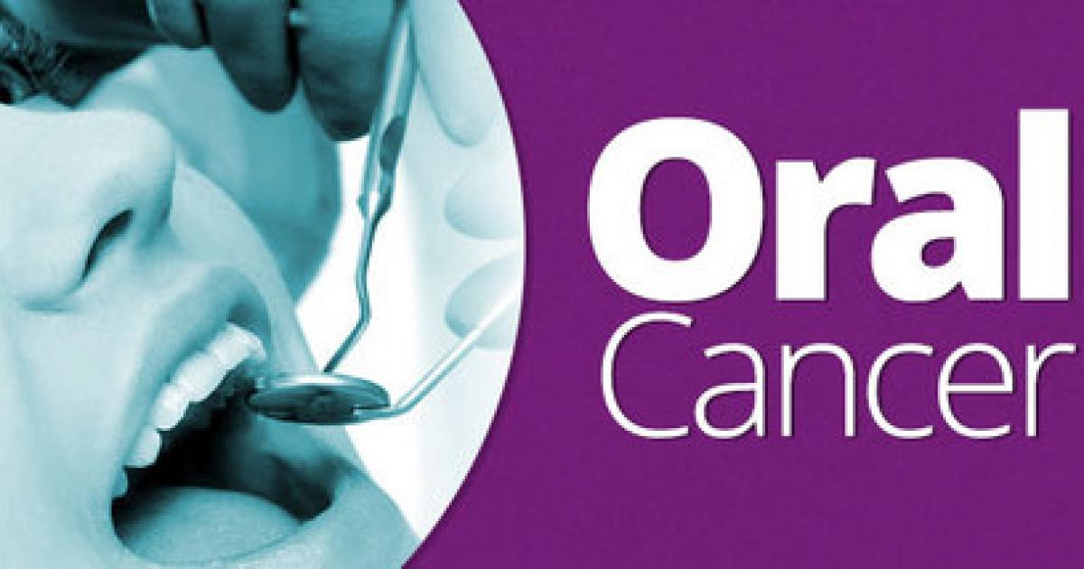Oral cancer, symptoms and avoid the disease, smoking, Sani Dental Group