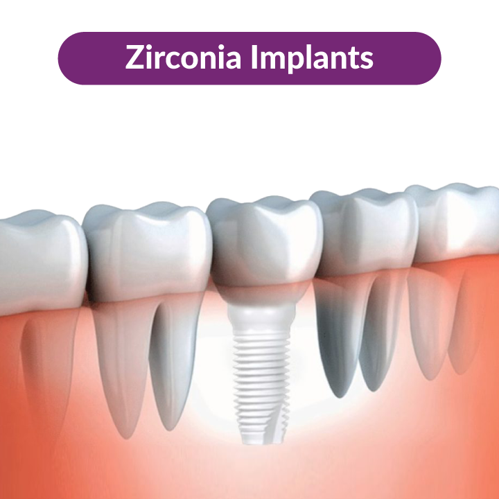 zirconium-implants