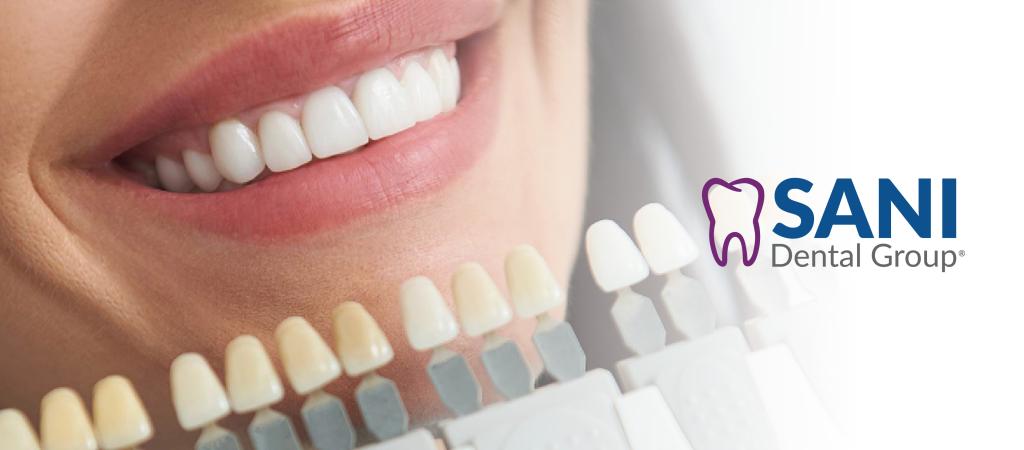 Veneers Cost Mexico: Affordable, High-Quality Cosmetic Dentistry