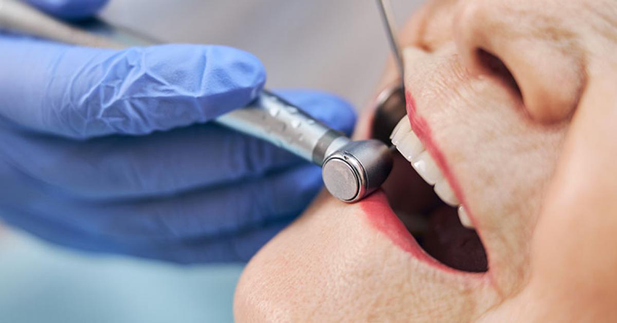 The Best Replacement for a Lost Tooth