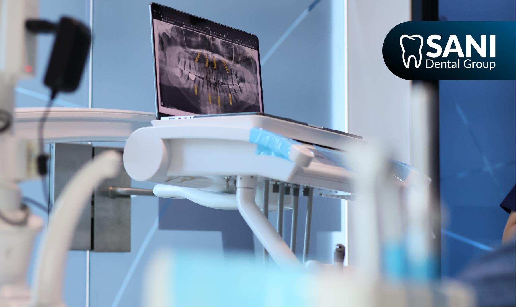 Sani-dental-group-affordable-all-on-4-cancun X rays of American all on 4 patient in Cancun Mexico for top dental care