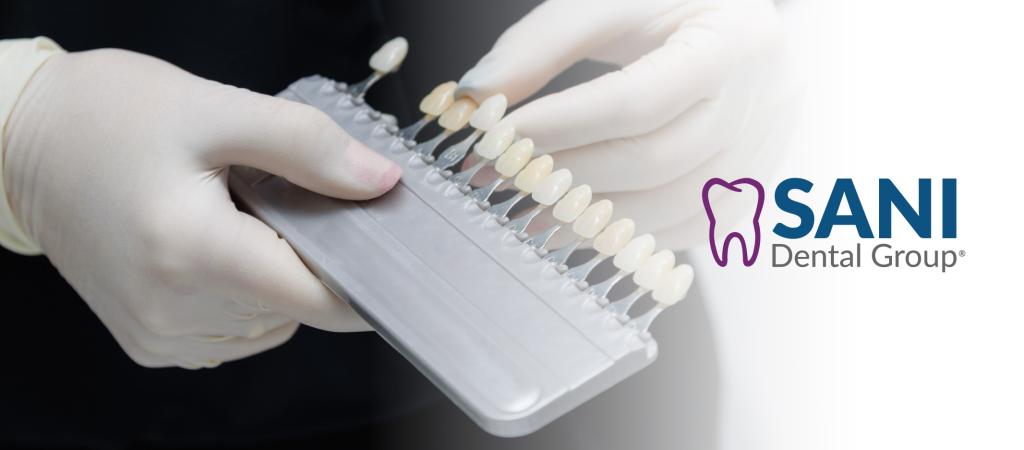 Is It Safe to Get Veneers in Mexico? Safety, Quality, and What Patients Should Know