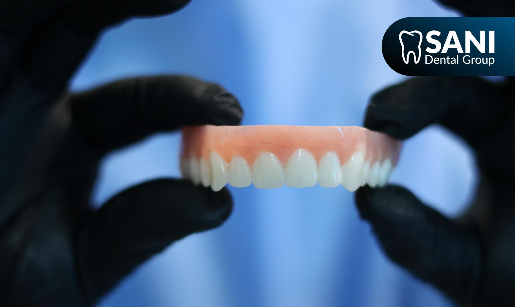 All-on-4 dental implant in Playa del Carmen