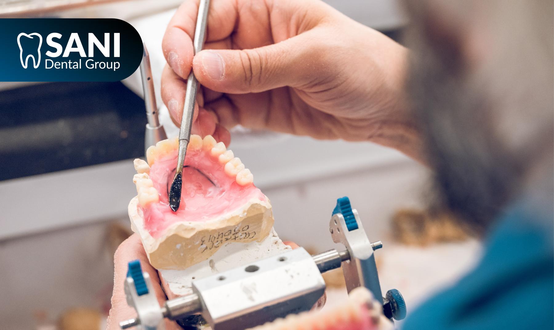 Top dental surgeon crafting all on 4 dental implant in Sani Dental Group laboratory