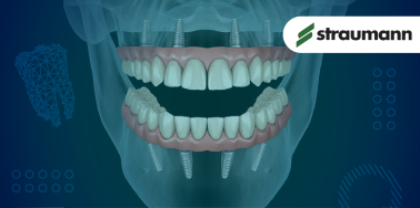 "All on Four" System by Straumann (w/fixed hybrid denture)