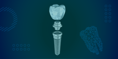 Titanium Dental Implant (implant only)