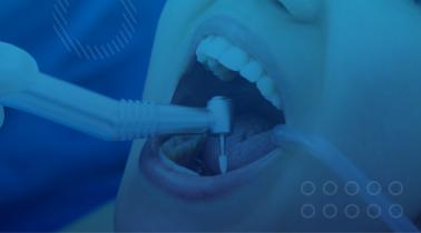 Dental Cleanings