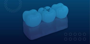 Dental Fillings