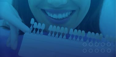 Dental Veneers