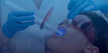 Teeth Whitening