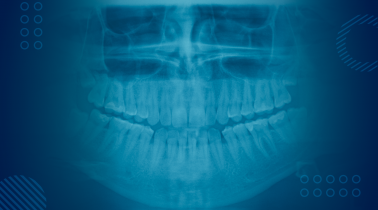 Panoramic X-rays
