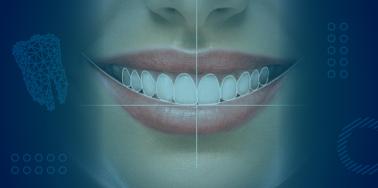 Smile Design in Mexico