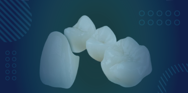 Zirconia Crown