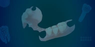 Partial Denture, Flexible Frame