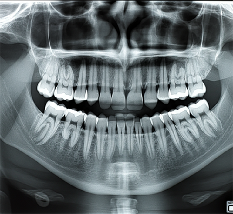 Dental X-rays (digital and panoramic) Technology